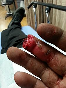 Purchased 05/05/18-finger-straight-view.jpeg